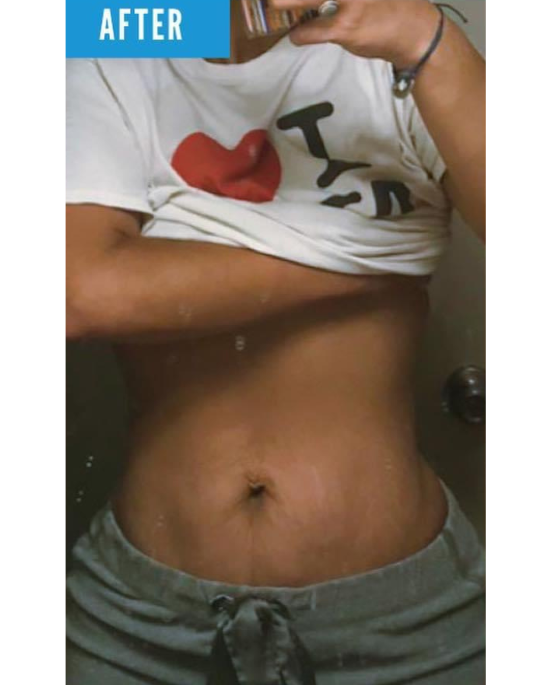 After Image
