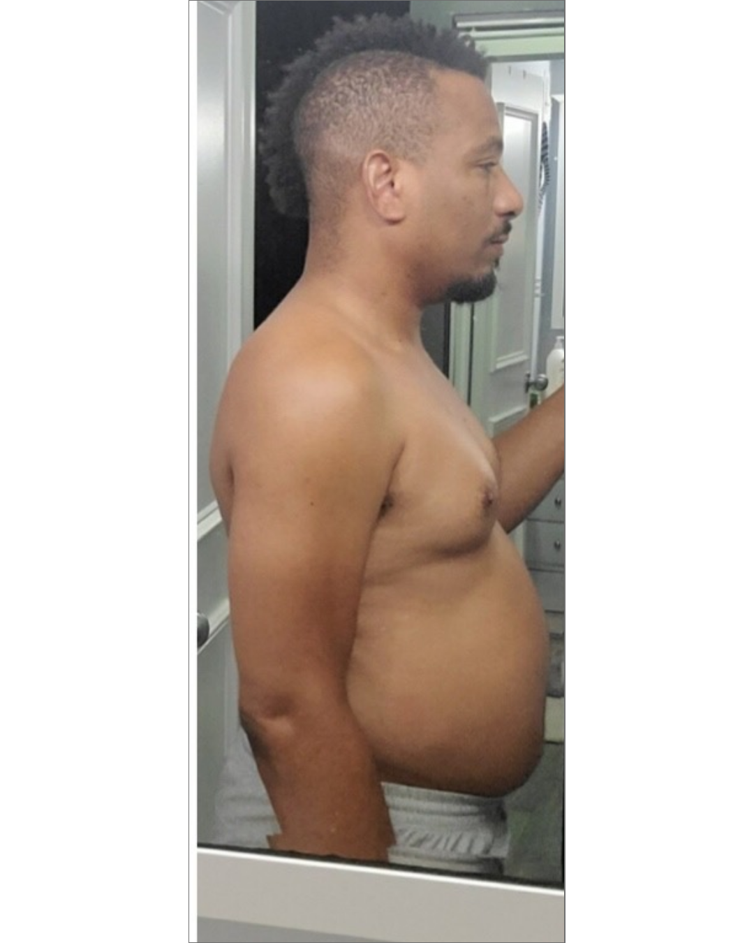 Before Image